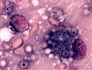 Histoplasmas - histoplazmozės sukėlėjas