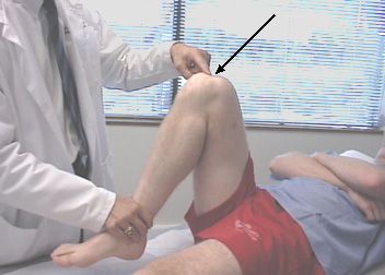 Skausmas kelio metu lenkimo metu yra labiausiai paplitusi priežastis, kodėl žmonės lankosi traumų gydytojams. 