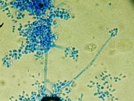 Favuso (Trichophyton schoenleinii) sukėlėjas
