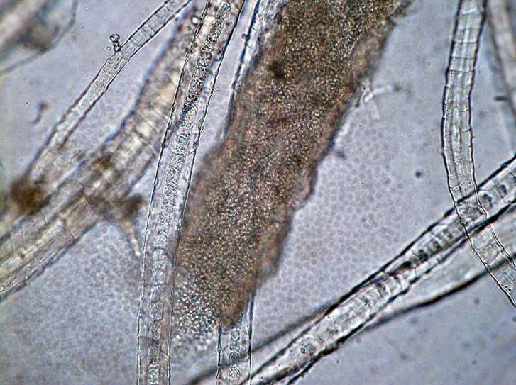 Epidermofitozės patogenai
